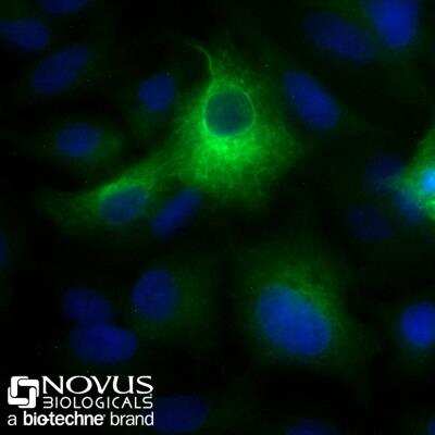 Immunocytochemistry/Immunofluorescence: Cytokeratin 19 Antibody (A53-B/A2.26) [Alexa Fluor 488] [NBP2-33134AF488] - HepG2 cells were fixed for 10 minutes using 10% formalin and then permeabilized for 5 minutes using 1X PBS + 0.5% Triton-X100.  The cells were incubated with anti-Cytokeratin 19 (A53-B/A2.26) conjugated to Alexa Fluor 488 [NBP2-33134AF488] at 10ug/ml for 1 hour at room temperature.  Nuclei were counterstained with DAPI (Blue).  Cells were imaged using a 40X objective.