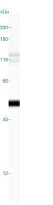 Simple Western: Cytokeratin 19 Antibody (BA17) - Azide and BSA Free [NBP2-34560] - Lane view shows a specific band for Cytokeratin 19 in 0.2 mg/ml of HeLa lysate(s). This experiment was performed under reducing conditions using the 12-230 kDa separation system.