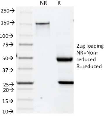 SDS-Page: Cytokeratin 19 Antibody (BA17) [NBP2-34271]