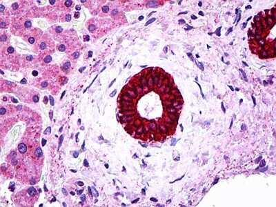 Immunohistochemistry-Paraffin: Cytokeratin 19 Antibody [NBP1-53204] - Human Bileduct Tissue, antibody concentration 5 ug/ml.