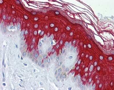 Immunohistochemistry-Paraffin: Cytokeratin 19 Antibody [NBP1-53204] - Human Skin tissue, 5 ug/ml.