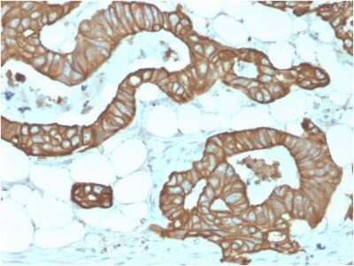 Immunohistochemistry-Paraffin: Cytokeratin 19 Antibody (KRT19/1959R) - Azide and BSA Free [NBP3-08635] - Formalin-fixed, paraffin-embedded human Colon stained with Cytokeratin 19 Rabbit Recombinant Monoclonal Antibody (KRT19/1959R).
