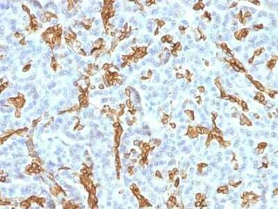 Immunohistochemistry-Paraffin: Cytokeratin 19 Antibody (KRT19/799 + KRT19/800) - IHC-Prediluted [NBP2-48101] - Human Pancreas stained with Cytokeratin 19 Monoclonal Antibody (KRT19/799 + KRT19/800)
