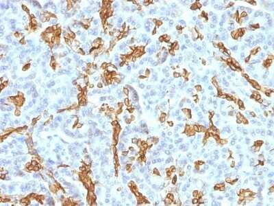 Immunohistochemistry-Paraffin: Cytokeratin 19 Antibody (KRT19/799 + KRT19/800) [NBP2-44829] - Human Pancreas stained with Cytokeratin 19 Monoclonal Antibody (KRT19/799 + KRT19/800)