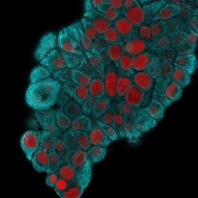 Immunocytochemistry/Immunofluorescence: Cytokeratin 19 Antibody (KRT19/800) - Azide and BSA Free [NBP2-47946] - Immunofluorescence Analysis of MeOH-fixed MCF-7 cells labeling CK19 using Cytokeratin 19 Antibody (KRT19/800) followed by Goat anti-Mouse IgG-CF488 (Cyan). The nuclear counterstain is Red Dot (Red)