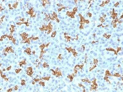 Immunohistochemistry-Paraffin: Cytokeratin 19 Antibody (KRT19/800) - Azide and BSA Free [NBP2-47946] - Human Pancreas stained with Cytokeratin 19 Monoclonal Antibody (KRT19/800)