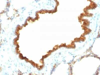 Immunohistochemistry-Paraffin: Cytokeratin 19 Antibody (KRT19/800) - Azide and BSA Free [NBP2-47946] - Rat Lung stained with Cytokeratin 19 Monoclonal Antibody (KRT19/800)