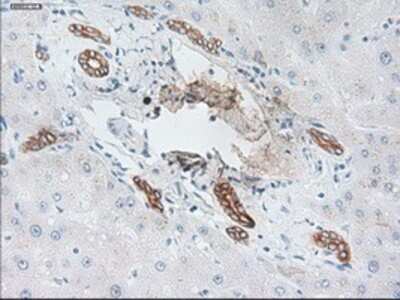 Immunohistochemistry: Cytokeratin 19 Antibody (OTI3F8) - Azide and BSA Free [NBP2-71092] - Staining of paraffin-embedded liver tissue using anti-Cytokeratin 19mouse monoclonal antibody.