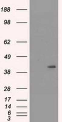 Western Blot: Cytokeratin 19 Antibody (OTI3F8) - Azide and BSA Free [NBP2-71092] - HEK293T cells were transfected with the pCMV6-ENTRY control (Left lane) or pCMV6-ENTRY Cytokeratin 19 (Right lane) cDNA for 48 hrs and lysed. Equivalent amounts of cell lysates (5 ug per lane) were separated by SDS-PAGE and immunoblotted with anti-Cytoker