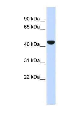 Western Blot: Cytokeratin 19 Antibody [NBP1-53204] - Antibody Titration: 0.2-1 ug/ml ELISA Titer: 1:62500 Positive Control: Human Lung