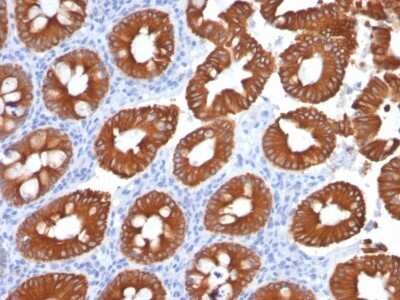 Immunohistochemistry-Paraffin: Cytokeratin 20 Antibody (KRT20/1991) [NBP3-08406] - Formalin-fixed, paraffin-embedded human Normal Colon stained with Cytokeratin 20 Mouse Monoclonal Antibody (KRT20/1991).