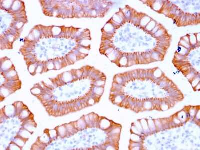 Immunohistochemistry-Paraffin: Cytokeratin 20 Antibody (KRT20/3129R) - Azide and BSA Free [NBP3-08636] - Formalin-fixed, paraffin-embedded human Colon stained with Cytokeratin 20 Recombinant Rabbit Monoclonal Antibody (KRT20/3129R).