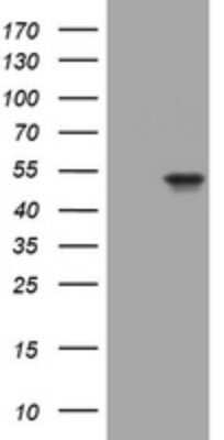 Western Blot: Cytokeratin 20 Antibody (OTI3G1) - Azide and BSA Free [NBP2-71962] - Analysis of HEK293T cells were transfected with the pCMV6-ENTRY control (Left lane) or pCMV6-ENTRY Cytokeratin 20.
