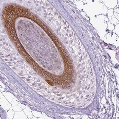 Immunohistochemistry-Paraffin: Cytokeratin 27 Antibody [NBP2-55440] - Staining of human hair shows strong cytoplasmic positivity in internal root sheath.