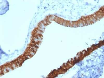 Immunohistochemistry-Paraffin: Cytokeratin 3 Antibody (KRT3/2130) - Azide and BSA Free [NBP2-79852] - Formalin-fixed, paraffin-embedded human Ovary stained with Cytokeratin 3 Antibody (KRT3/2130).