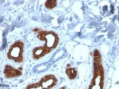 Immunohistochemistry-Paraffin: Cytokeratin 3 Antibody (KRT3/2130) - Azide and BSA Free [NBP2-79852] - Formalin-fixed, paraffin-embedded human Skin stained with Cytokeratin 3 Antibody (KRT3/2130).