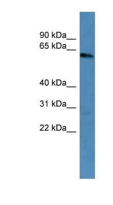 Western Blot: Cytokeratin 3 Antibody [NBP1-69045] - Human Brain lysate, concentration 0.2-1 ug/ml.