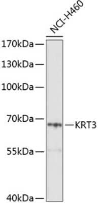 Western Blot: Cytokeratin 3 Antibody [NBP2-91997] - Analysis of extracts of H460 cells, using Cytokeratin 3 at 1:1000 dilution.Secondary antibody: HRP Goat Anti-Rabbit IgG (H+L) at 1:10000 dilution.Lysates/proteins: 25ug per lane.Blocking buffer: 3% nonfat dry milk in TBST.Detection: ECL Basic Kit .Exposur