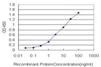 ELISA: Cytokeratin 4 Antibody (5H5) [H00003851-M01] - Detection limit for recombinant GST tagged KRT4 is approximately 0.1ng/ml as a capture antibody.