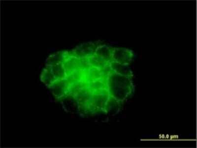 Immunocytochemistry/Immunofluorescence: Cytokeratin 4 Antibody (5H5) [H00003851-M01] - Analysis of monoclonal antibody to KRT4 on A-431 cell. Antibody concentration 10 ug/ml.