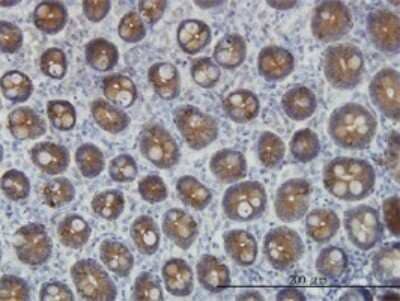 Immunohistochemistry-Paraffin: Cytokeratin 4 Antibody (5H5) [H00003851-M01] - Analysis of monoclonal antibody to KRT4 on formalin-fixed paraffin-embedded human small Intestine. Antibody concentration 3 ug/ml.