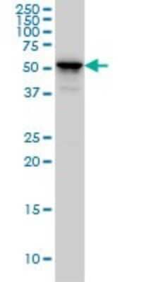 Western Blot: Cytokeratin 4 Antibody (5H5) [H00003851-M01] - KRT4 monoclonal antibody (M01), clone 5H5 Analysis of KRT4 expression in A-431.