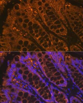 Immunohistochemistry Cytokeratin 4 Antibody (6H9R6)