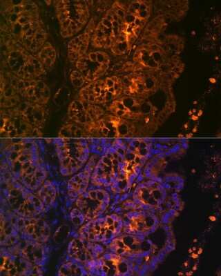 Immunohistochemistry Cytokeratin 4 Antibody (6H9R6)