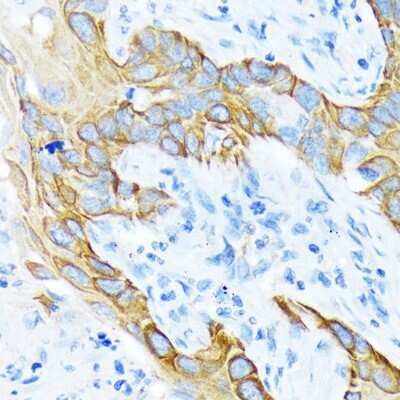 Immunohistochemistry-Paraffin Cytokeratin 4 Antibody (6H9R6)