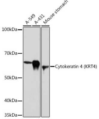 Western Blot: Cytokeratin 4 Antibody (6H9R6) [NBP3-15243] - Western blot analysis of extracts of various cell lines, using Cytokeratin 4 (KRT4) Rabbit mAb (NBP3-15243) at 1:1000 dilution. Secondary antibody: HRP Goat Anti-Rabbit IgG (H+L) at 1:10000 dilution. Lysates/proteins: 25ug per lane. Blocking buffer: 3% nonfat dry milk in TBST. Detection: ECL Basic Kit. Exposure time: 30s.