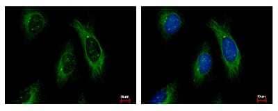 Immunocytochemistry/Immunofluorescence: Cytokeratin 4 Antibody [NBP1-33412] - Sample: HeLa cells were fixed in iced-cold MeOH for 5 min. Green: KRT4 protein stained by Cytokeratin 4 antibody diluted at 1:500. Blue: Hoechst 33343 staining.