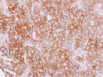 Immunohistochemistry-Paraffin: Cytokeratin 4 Antibody [NBP1-33412] - Paraffin-embedded BT474 xenograft, using antibody at 1:500 dilution.