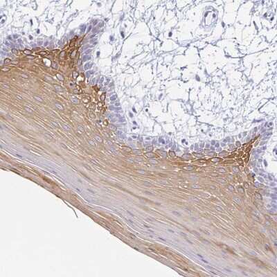 Immunohistochemistry-Paraffin: Cytokeratin 4 Antibody [NBP2-33984] - Staining of human oral mucosa shows moderate cytoplasmic positivity in squamous epithelial cells.