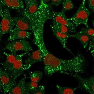 Immunocytochemistry/Immunofluorescence: Cytokeratin 4 Antibody (KRT4/2804) [NBP3-07797] - Immunofluorescence Analysis of A549 cells labeling KRT4 with Cytokeratin 4 Mouse Monoclonal Antibody (KRT4/2804)followed by goat anti- Mouse IgG-CF488 (Green). The nuclear counterstain is RedDot (Red).