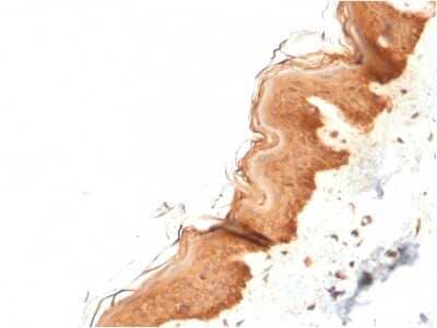 Immunohistochemistry-Paraffin: Cytokeratin 4 Antibody (KRT4/2804) [NBP3-07797] - Formalin-fixed, paraffin-embedded human Skin stained with Cytokeratin 4 Mouse Monoclonal Antibody (KRT4/2804).