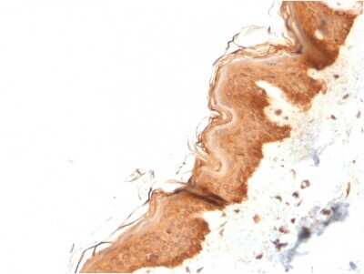 Immunohistochemistry-Paraffin: Cytokeratin 4 Antibody (KRT4/2804) [NBP3-08583] - Formalin-fixed, paraffin-embedded human Skin stained with Cytokeratin 4 Mouse Monoclonal Antibody (KRT4/2804).