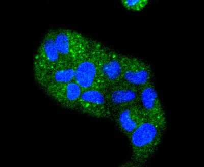 Immunocytochemistry/Immunofluorescence: Cytokeratin 4 Antibody (SN2001) [NBP2-67727] - Staining Cytokeratin 4 in Hela cells (green). The nuclear counter stain is DAPI (blue). Cells were fixed in paraformaldehyde, permeabilised with 0.25% Triton X100/PBS.
