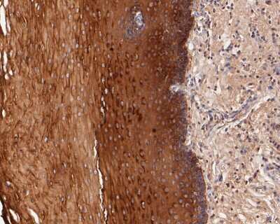 Immunohistochemistry-Paraffin: Cytokeratin 4 Antibody (SN2001) [NBP2-67727] - Immunohistochemical analysis of paraffin-embedded human esophagus tissue using anti-Cytokeratin 4 antibody. The section was pre-treated using heat mediated antigen retrieval with Tris-EDTA buffer (pH 8.0-8.4) for 20 minutes. The tissues were blocked in 5% BSA for 30 minutes at room temperature, washed with ddH2O and PBS, and then probed with the primary antibody (1/50) for 30 minutes at room temperature. The detection was performed using an HRP conjugated compact polymer system. DAB was used as the chromogen. Tissues were counterstained with hematoxylin and mounted with DPX.