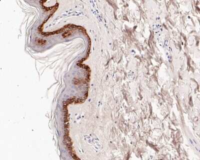 Immunohistochemistry-Paraffin: Cytokeratin 4 Antibody (SN2001) [NBP2-67727] - Immunohistochemical analysis of paraffin-embedded human skin tissue using anti-Cytokeratin 4 antibody. The section was pre-treated using heat mediated antigen retrieval with Tris-EDTA buffer (pH 8.0-8.4) for 20 minutes. The tissues were blocked in 5% BSA for 30 minutes at room temperature, washed with ddH2O and PBS, and then probed with the primary antibody (1/200) for 30 minutes at room temperature. The detection was performed using an HRP conjugated compact polymer system. DAB was used as the chromogen. Tissues were counterstained with hematoxylin and mounted with DPX.