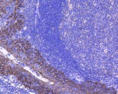 Immunohistochemistry-Paraffin: Cytokeratin 4 Antibody (SN2001) [NBP2-67727] - Immunohistochemical analysis of paraffin-embedded human tonsil tissue using anti-Cytokeratin 4 antibody. The section was pre-treated using heat mediated antigen retrieval with Tris-EDTA buffer (pH 8.0-8.4) for 20 minutes. The tissues were blocked in 5% BSA for 30 minutes at room temperature, washed with ddH2O and PBS, and then probed with the primary antibody (1/50) for 30 minutes at room temperature. The detection was performed using an HRP conjugated compact polymer system. DAB was used as the chromogen. Tissues were counterstained with hematoxylin and mounted with DPX.