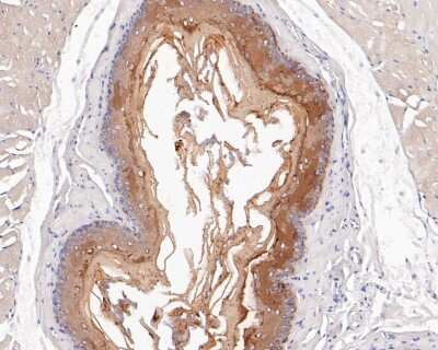 Immunohistochemistry-Paraffin: Cytokeratin 4 Antibody (SN2001) [NBP2-67727] - Immunohistochemical analysis of paraffin-embedded rat esophagus tissue using anti-Cytokeratin 4 antibody. The section was pre-treated using heat mediated antigen retrieval with Tris-EDTA buffer (pH 8.0-8.4) for 20 minutes. The tissues were blocked in 5% BSA for 30 minutes at room temperature, washed with ddH2O and PBS, and then probed with the primary antibody (1/50) for 30 minutes at room temperature. The detection was performed using an HRP conjugated compact polymer system. DAB was used as the chromogen. Tissues were counterstained with hematoxylin and mounted with DPX.