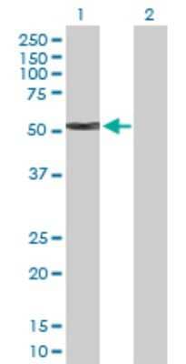 Western Blot: Cytokeratin 4 Antibody [H00003851-D01P] - Analysis of KRT4 expression in transfected 293T cell line by KRT4 polyclonal antibody.Lane 1: KRT4 transfected lysate(57.30 KDa).Lane 2: Non-transfected lysate.