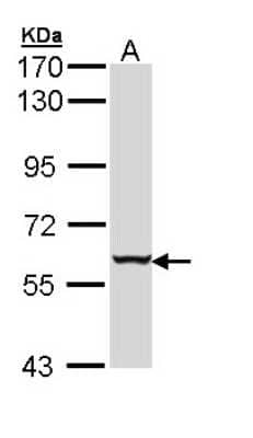 Western Blot: Cytokeratin 4 Antibody [NBP1-33412] - Sample (30 ug of whole cell lysate) A: Hela 7. 5% SDS PAGE; antibody diluted at 1:1000.