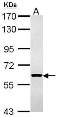 Western Blot: Cytokeratin 4 Antibody [NBP1-33592] - Sample (30 ug of whole cell lysate) A: H1299 7. 5% SDS PAGE; antibody diluted at 1:1000.