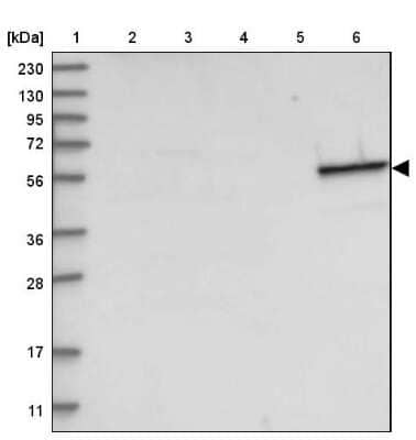 Western Blot: Cytokeratin 4 Antibody [NBP2-33984] - Lane 1: Marker  [kDa] 230, 130, 95, 72, 56, 36, 28, 17, 11.  Lane 2: Human cell line RT-4.  Lane 3: Human cell line U-251MG sp.  Lane 4: Human plasma (IgG/HSA depleted).  Lane 5: Human liver tissue.  Lane 6: Human tonsil tissue