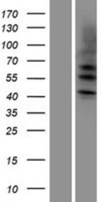 Western Blot: Cytokeratin 4 Overexpression Lysate (Adult Normal) [NBP2-10820] Left-Empty vector transfected control cell lysate (HEK293 cell lysate); Right -Over-expression Lysate for Cytokeratin 4.