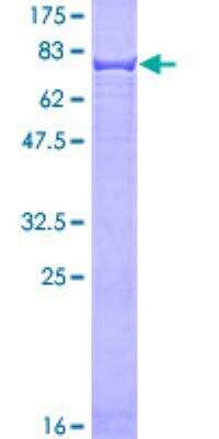 SDS-Page: Cytokeratin 4 Recombinant Protein [H00003851-P01]