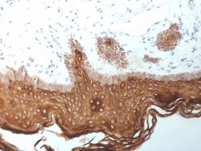 Immunohistochemistry-Paraffin: Cytokeratin 5/6/18 Antibody (SPM267) [NBP3-07606] - Formalin-fixed, paraffin-embedded human Skin stained with Cytokeratin 5/6/18 Mouse Monoclonal Antibody (SPM267).