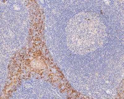 Immunohistochemistry-Paraffin: Cytokeratin 5/6 Antibody (A2A12) [NBP2-80401] - Analysis in human tonsil tissue using Cytokeratin 6a antibody. The section was pre-treated using heat mediated antigen retrieval with Tris-EDTA buffer (pH 8.0-8.4) for 20 minutes. The tissues were blocked in 5% BSA for 30 minutes at room temperature, wash