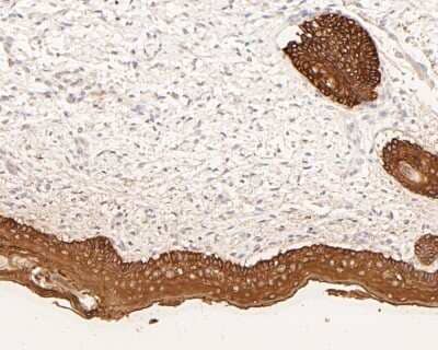 Immunohistochemistry-Paraffin: Cytokeratin 5/6 Antibody (A2A12) [NBP2-80401] - Analysis in human skin tissue using Cytokeratin 6a antibody. The section was pre-treated using heat mediated antigen retrieval with Tris-EDTA buffer (pH 8.0-8.4) for 20 minutes. The tissues were blocked in 5% BSA for 30 minutes at room temperature, washed